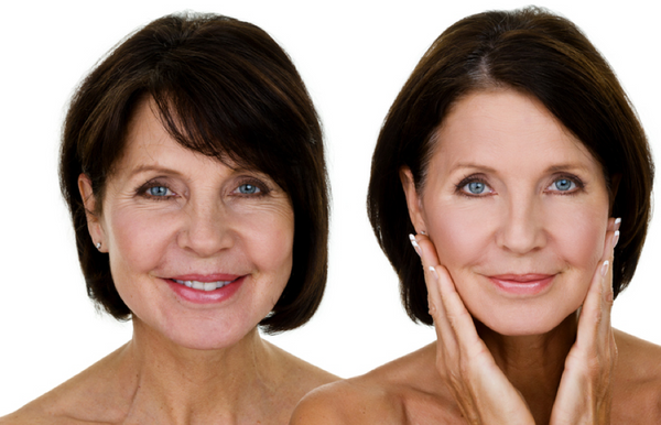 The 4 Different Wrinkle Types and How to Treat Each One